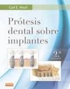 Prótesis Dental Sobre Implantes, 2ª Ed.
